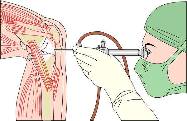 Dr Dan Albright arthroscopic knee surgery