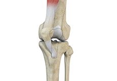 Knee Instability